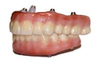 Permanent Dentures in Trichy