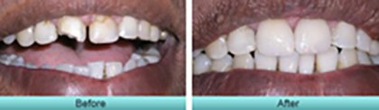 Smile Gallery