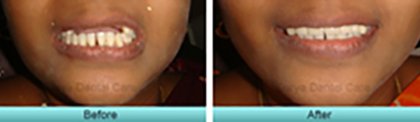 Smile Gallery