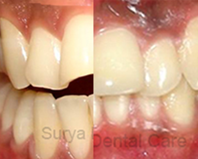 Our Smile Gallery
