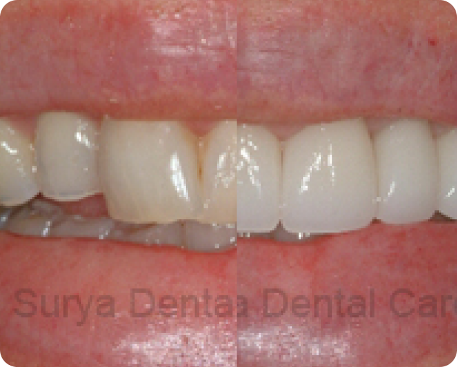 Our Smile Gallery