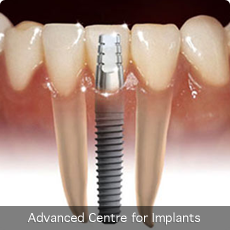 Facilities Surya Dental Care