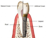 Treatment options