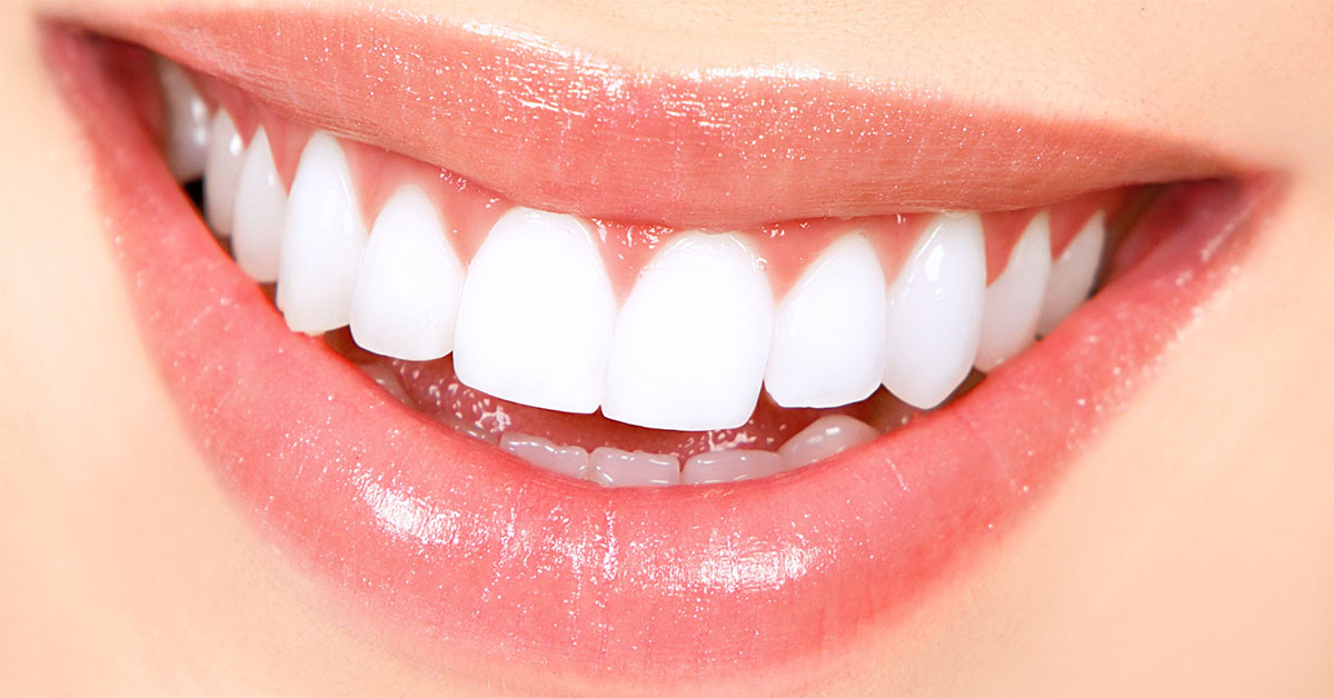 How to Maintain Sparkling White Teeth All Your Life