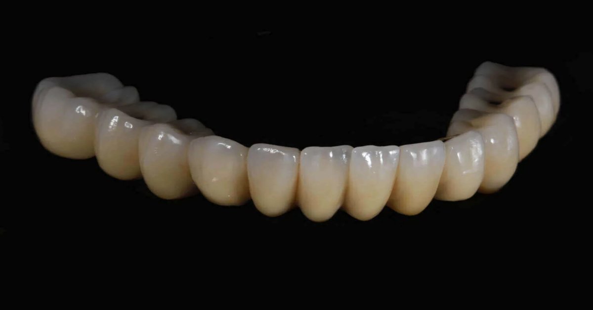 Tooth Bridges