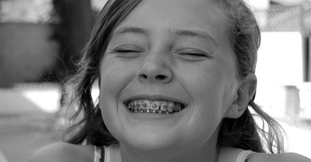 9 easy tips to reduce Braces Pain