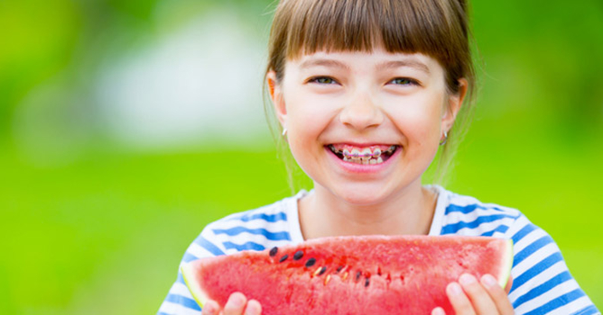 Eating with dental braces – 7 important things to consider