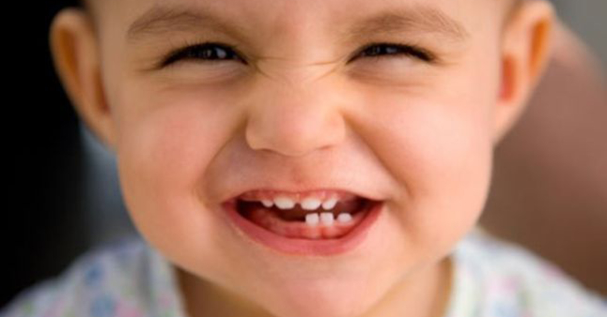 Kid with milk Teeth
