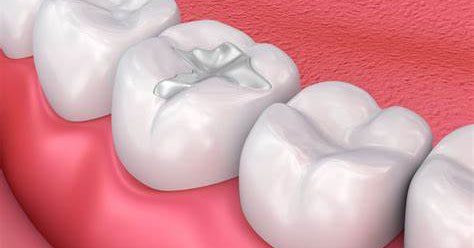 Dental Fillings
