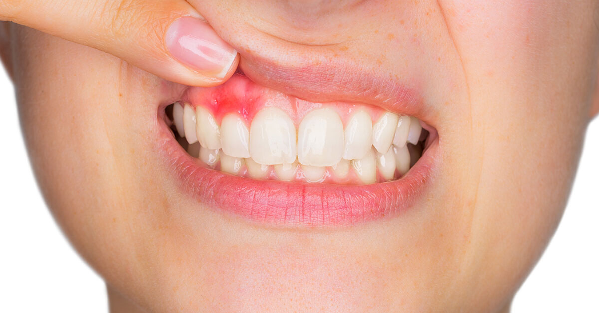 Long term risks of untreated gum diseases
