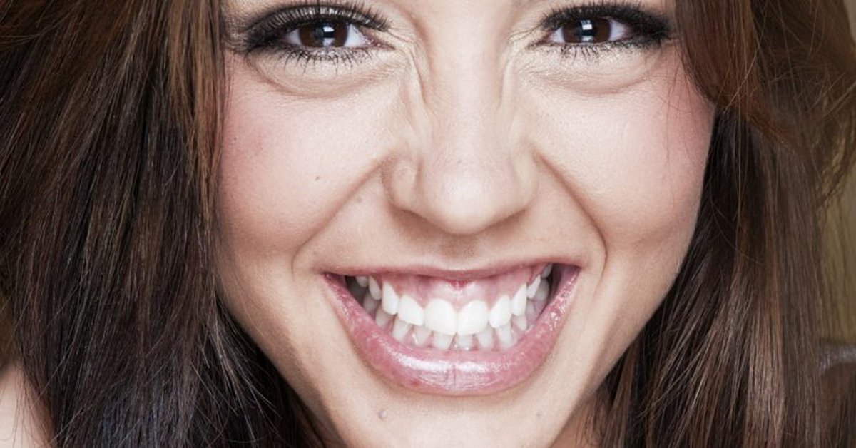 Gummy Smile