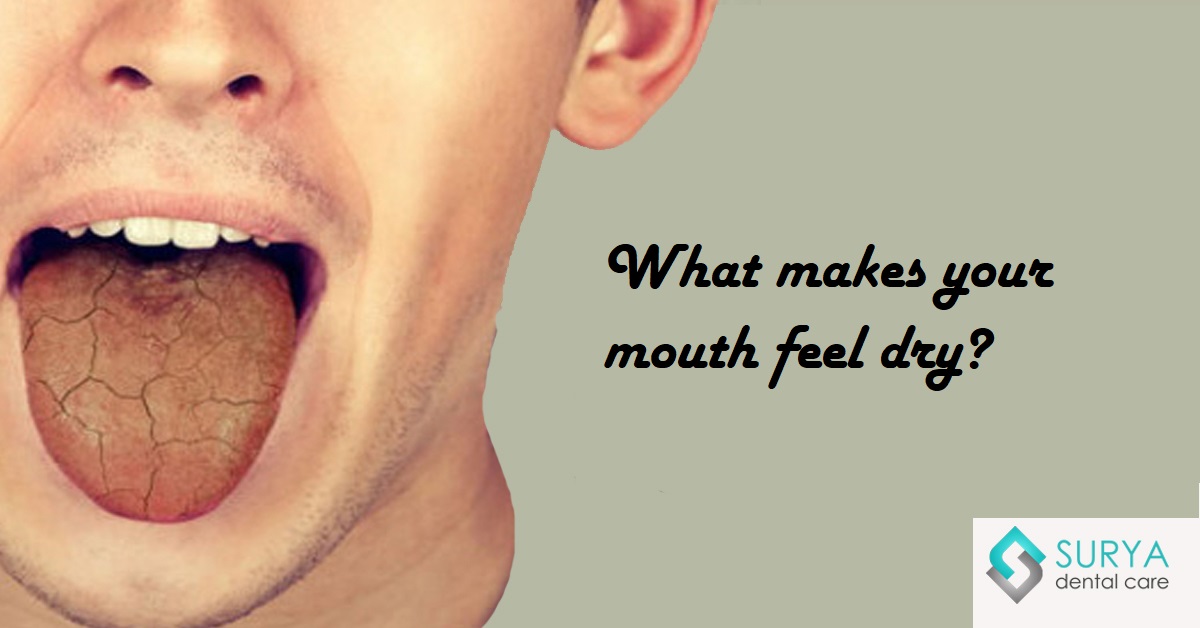 Dry Mouth