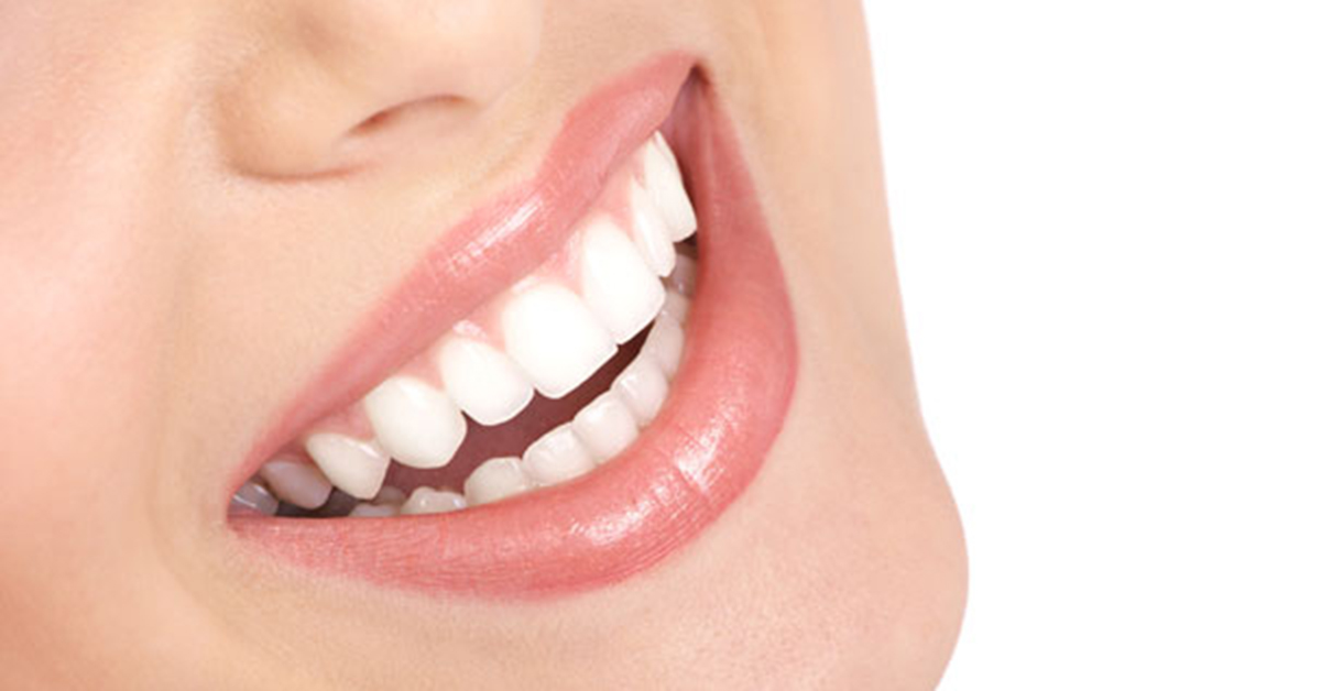 White Teeth
