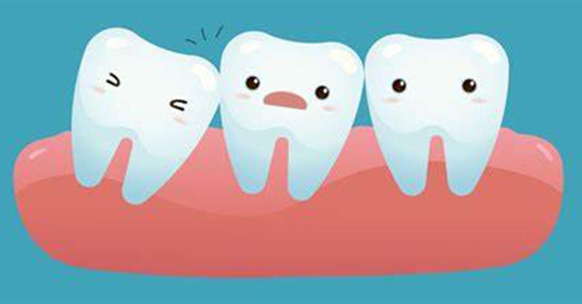 Wisdom Tooth
