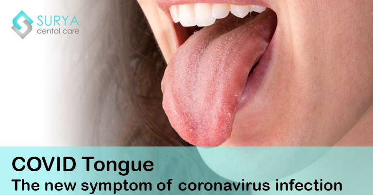 COVID Tongue - The new symptom of coronavirus infection