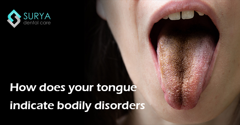 How does your tongue indicate bodily disorders