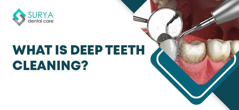 What is deep teeth cleaning?