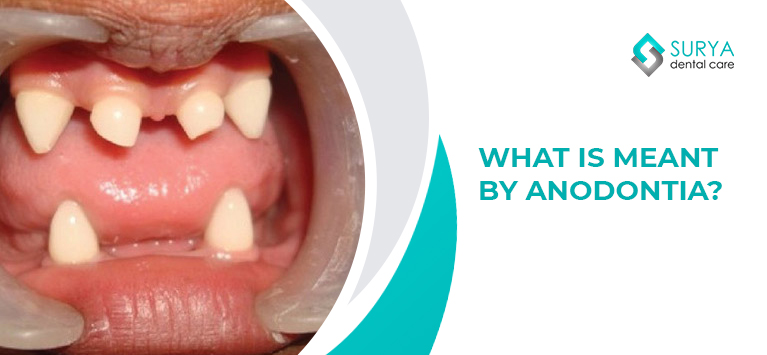 What is meant by Anodontia?