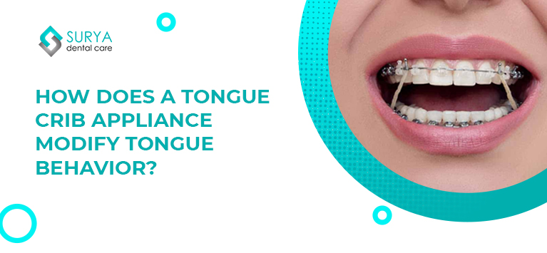 How does a tongue crib appliance modify tongue behavior?