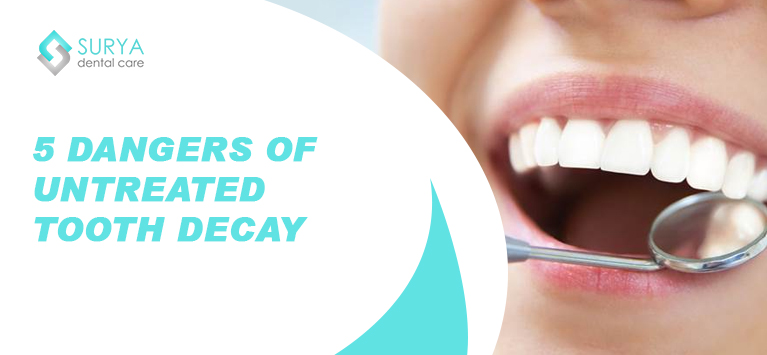 5 dangers of untreated tooth decay