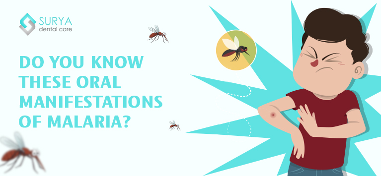 Do you know these oral manifestations of malaria?