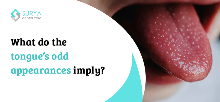What do the tongue’s odd appearances imply?