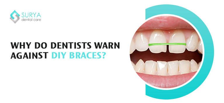 Why do dentists warn against DIY braces?