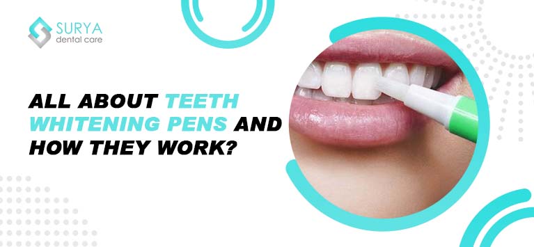 All about teeth whitening pens and how they work