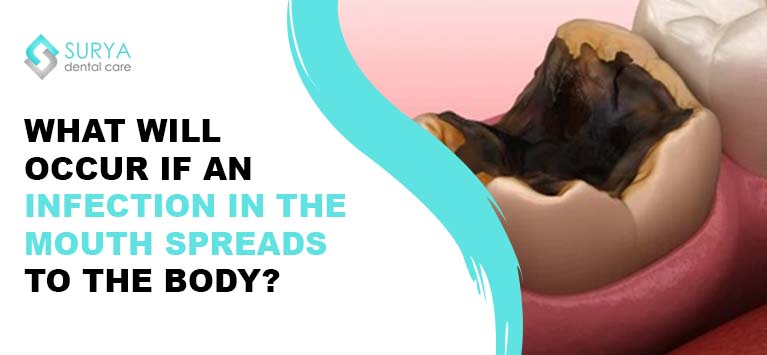 What will occur if an infection in the mouth spreads to the body?