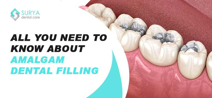 All you need to know about Amalgam Dental Fillings