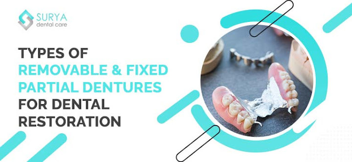 Types-of-removable-fixed-partial-dentures-for-dental-restoration