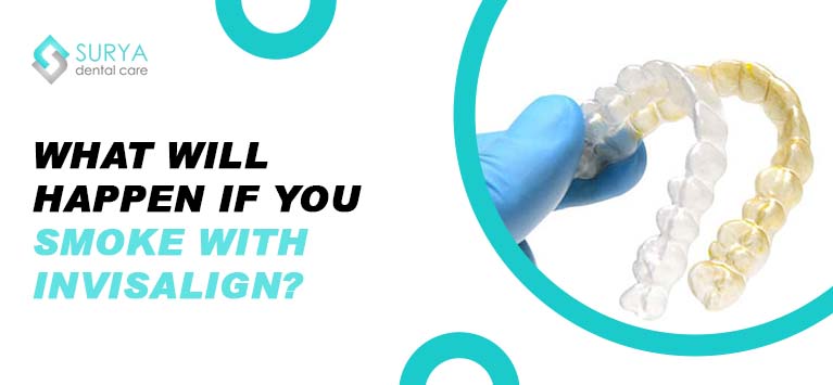 smoke with Invisalign