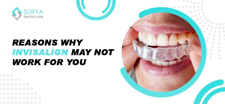 Reasons Why Invisalign May Not Work For You