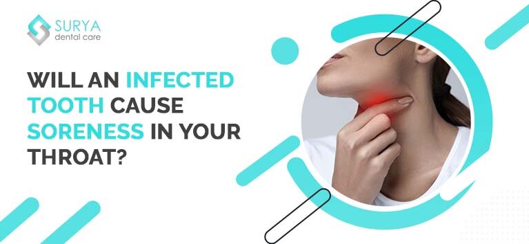 Will an infected tooth cause soreness in your throat?