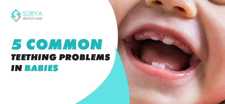 5 Common teething problems in babies