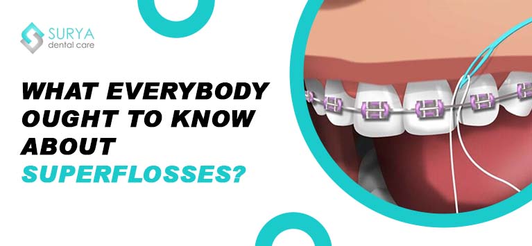 What everybody ought to know about Superflosses?