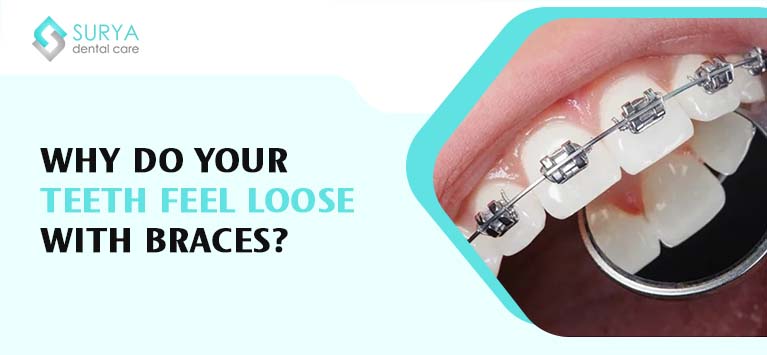Why do your teeth feel loose with braces?