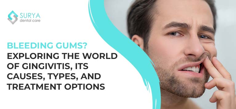 Bleeding Gums? Exploring the World of Gingivitis, its causes, types, and treatment options